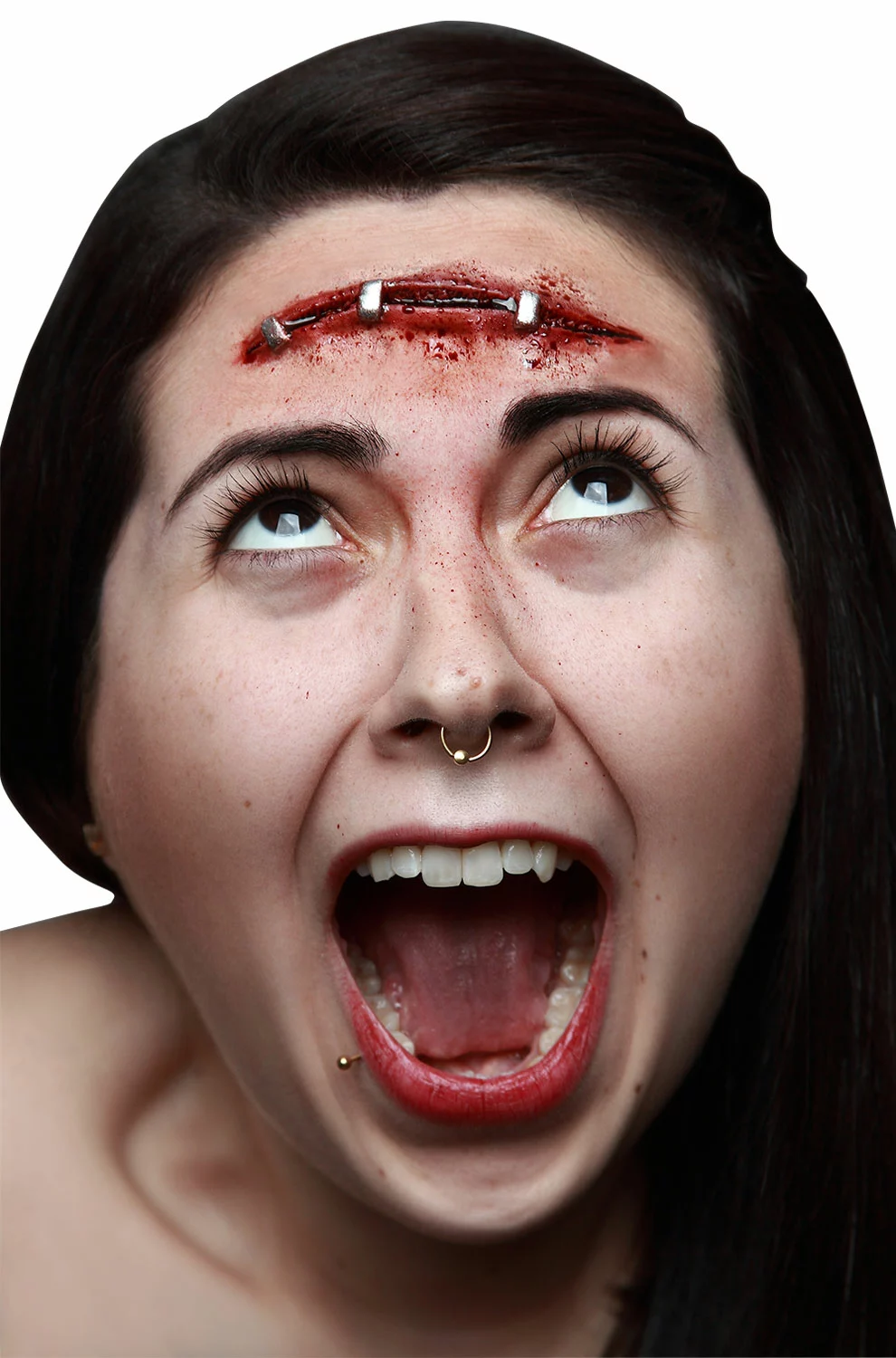 Metal Staples Prosthetic Kit